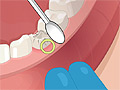Игра Установка зубного импланта